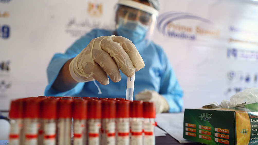 Leve descenso en casos positivos en la previa del recambio de quincena