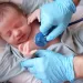 Bronquiolitis: una enfermedad respiratoria que afecta principalmente a los niños pequeños